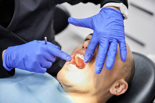 Best Dental Abscess Treatment in Fremont, CA